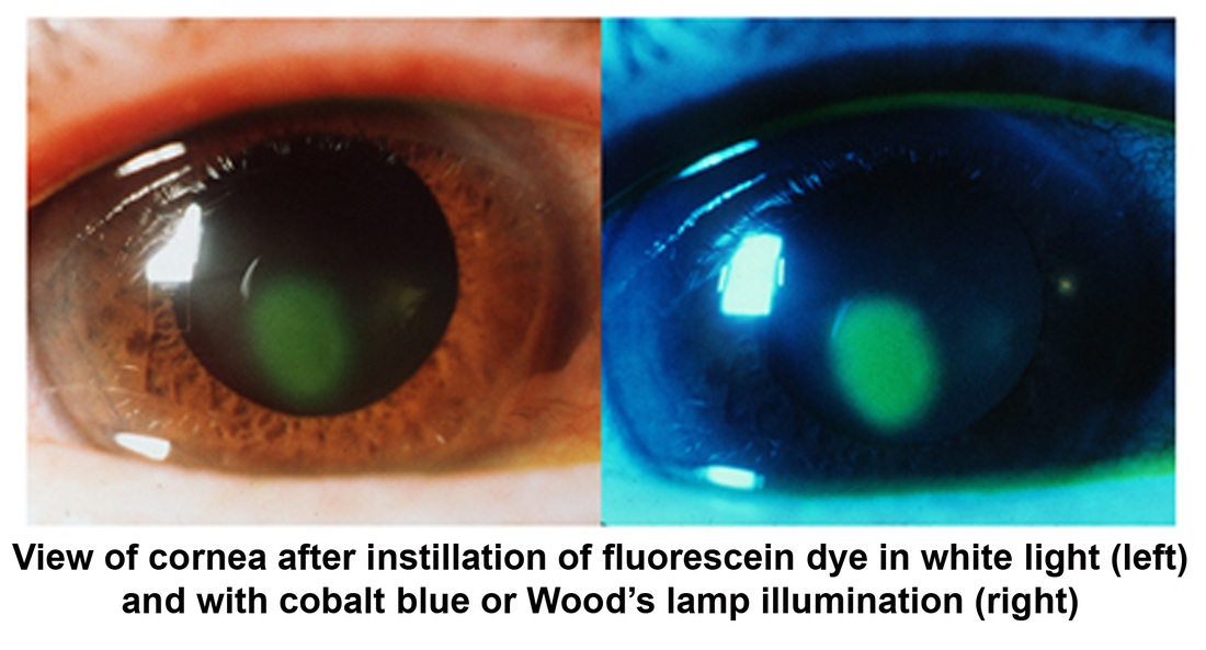 Fluorescéine - Outils pour diagnostiquerun problème visuelet